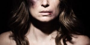 SNW-Website-Battle-Scars-2000x1005